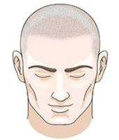 Alopecia SMP cost