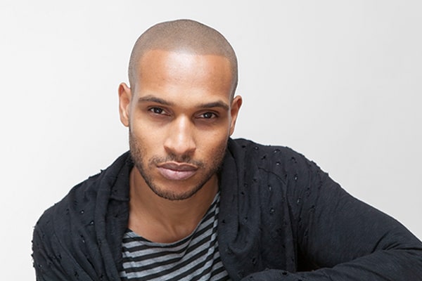 Scalp Micropigmentation Lloyd