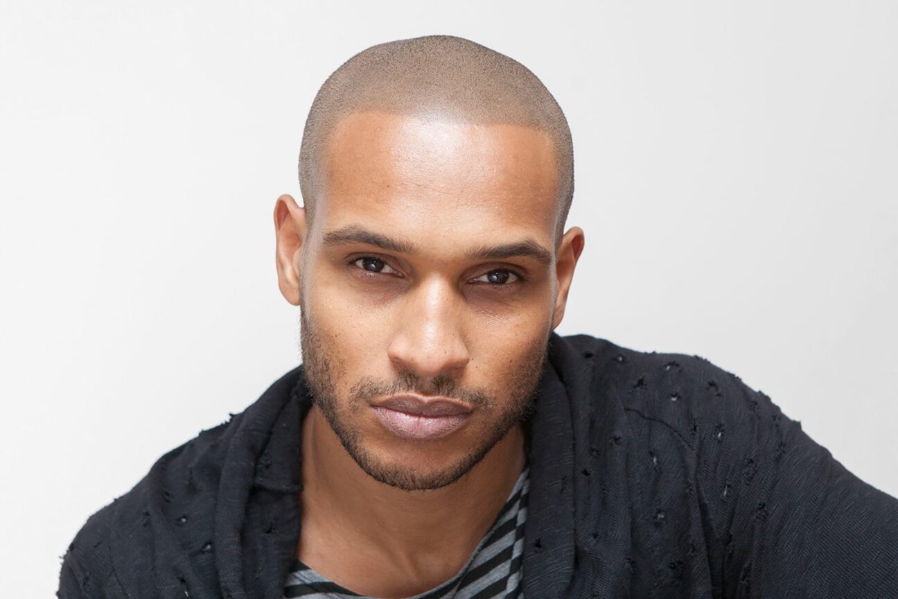 London Scalp Micropigmentation