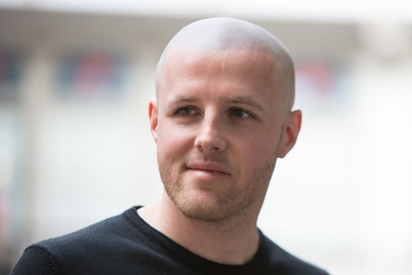 Scalp Micropigmentation Manchester Aaron