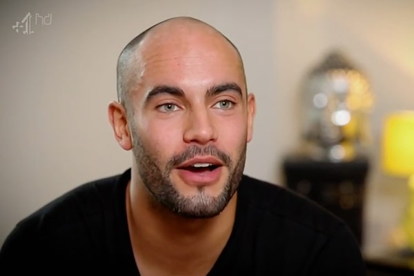 Scalp Micropigmentation Manchester Adam Part 1