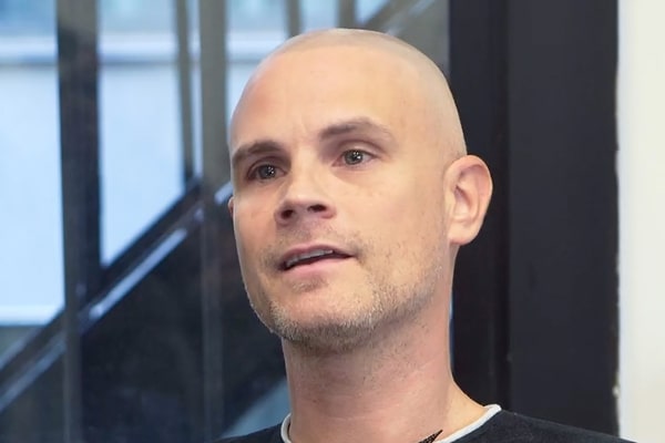 Scalp Micropigmentation Los Angeles Andy