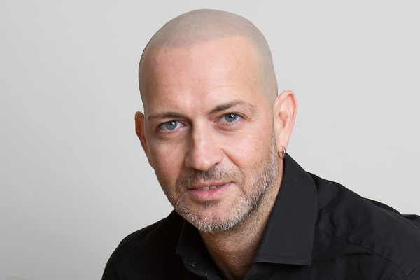 Scalp Micropigmentation London Antonio