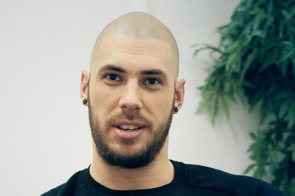 Scalp Micropigmentation Manchester Christian
