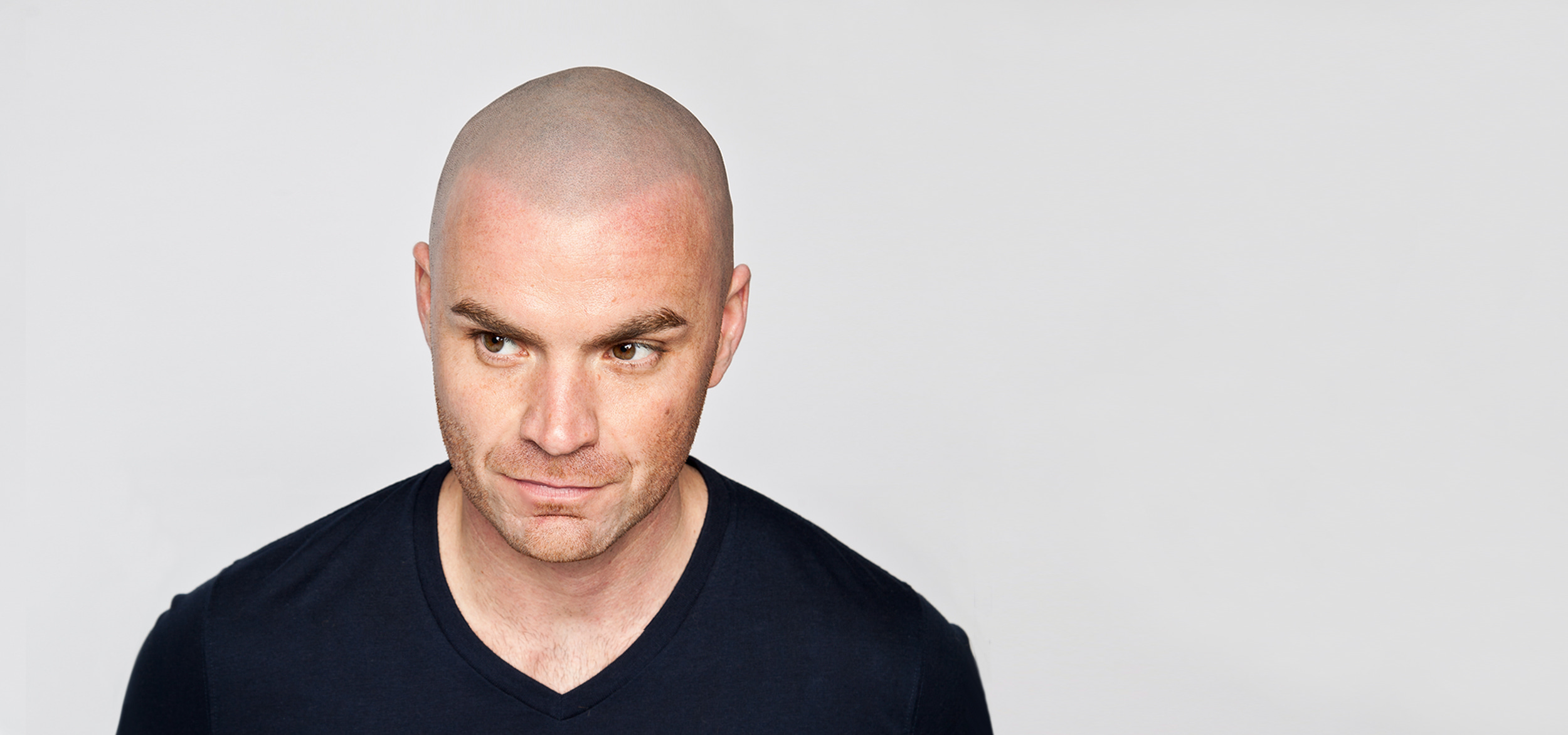 Scalp Micropigmentation Contact Page