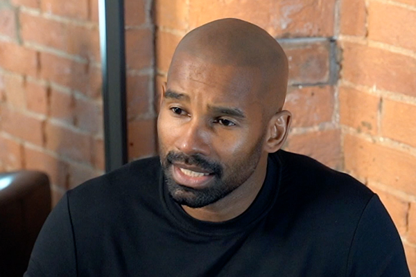 Scalp Micropigmentation Daryl