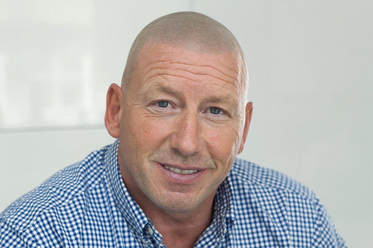 Scalp Micropigmentation Dublin