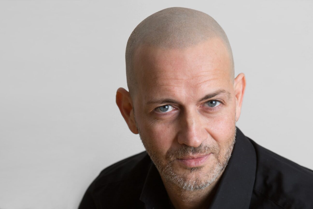 Scalp Micropigmentation Edinburgh