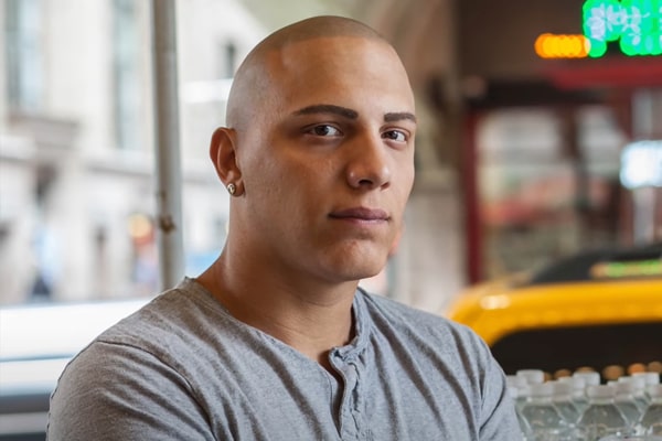 Scalp Micropigmentation Los Angeles Joe