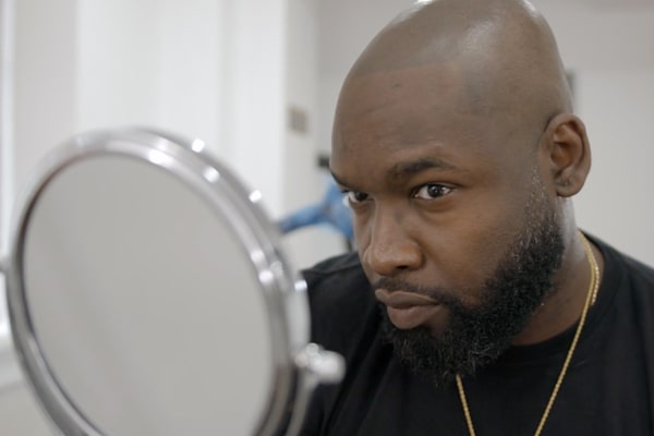 Scalp Micropigmentation Los Angeles Jon Black