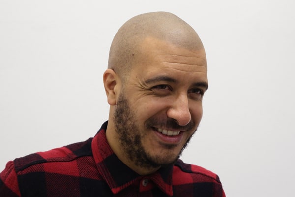 Scalp Micropigmentation Manchester Krishen
