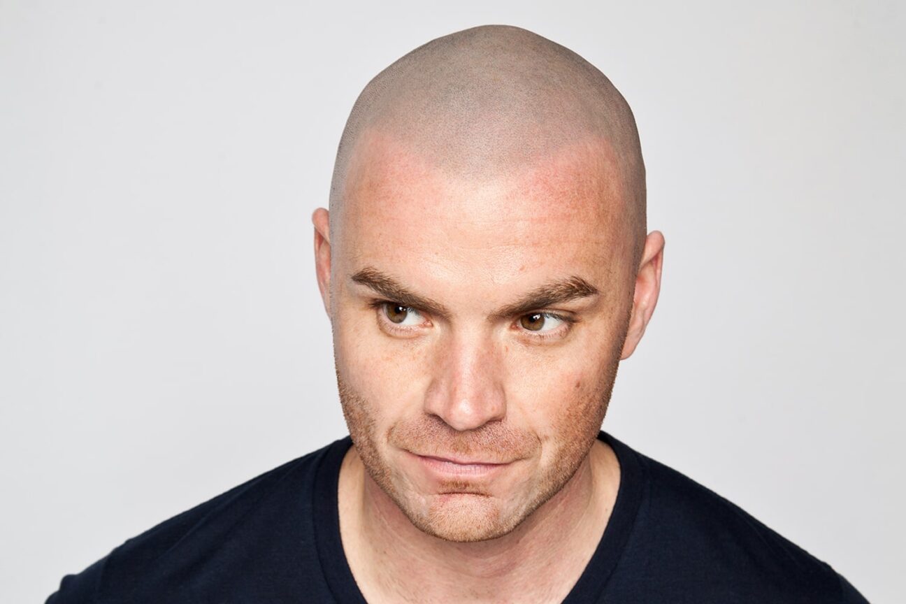 Scalp Micropigmentation London