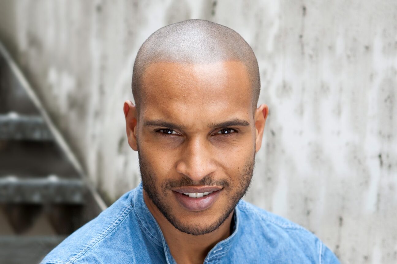 Scalp Micropigmentation Los Angeles