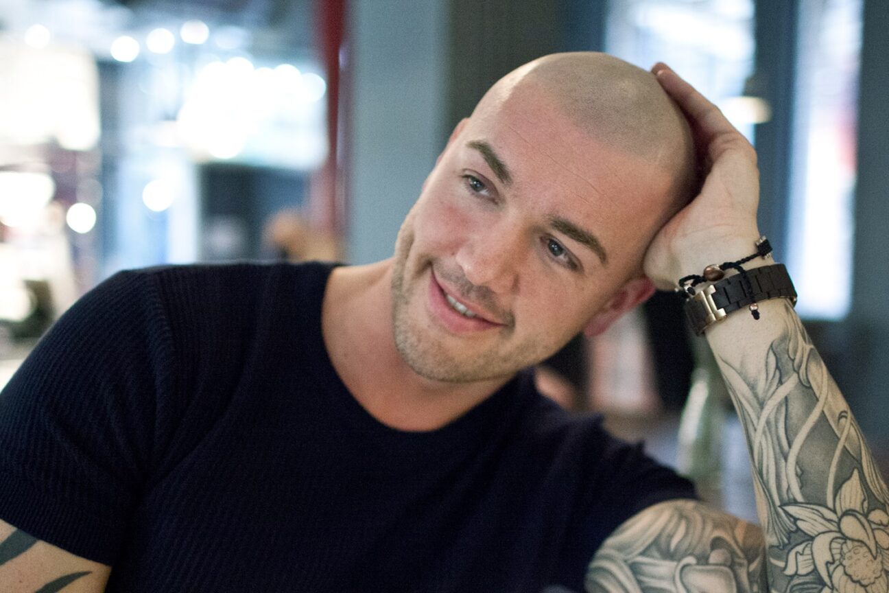 Scalp Micropigmentation Manchester