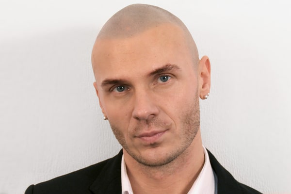 Scalp Micropigmentation London Marcin