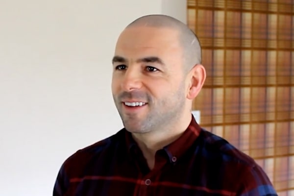 Scalp Micropigmentation Edinburgh Melvin