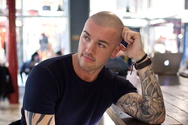 Scalp Micropigmentation Michael