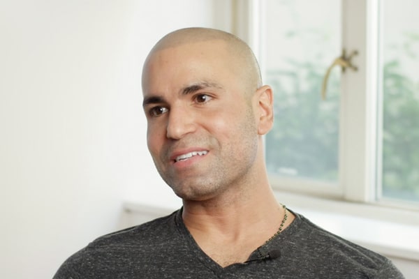 Scalp Micropigmentation Los Angeles Omar