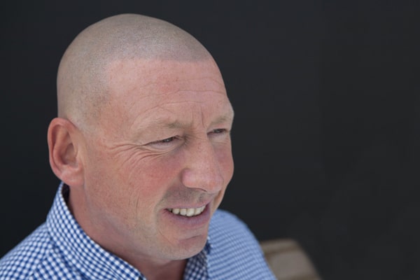 Scalp Micropigmentation London Roy