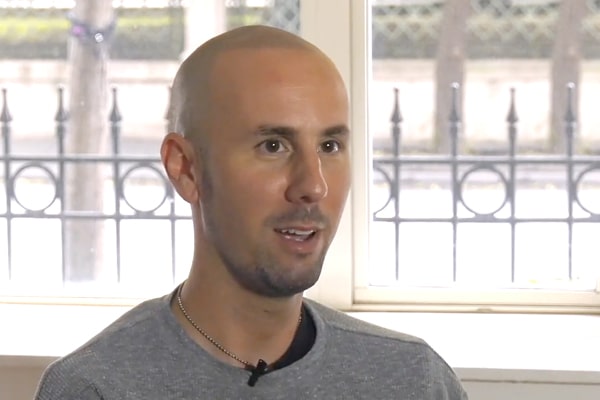 Scalp Micropigmentation Los Angeles Santino