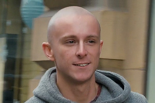 Scalp Micropigmentation Manchester Shane