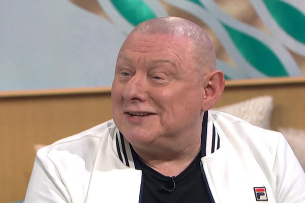Scalp Micropigmentation Manchester Shaun Ryder