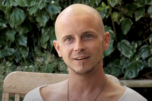 Scalp Micropigmentation London Tristan T