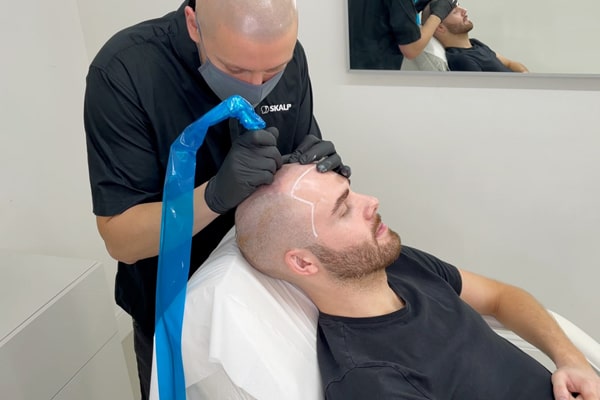 SMP Treatment Process