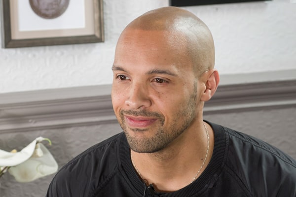 Tristan Scalp Micropigmentation 5 year touch up