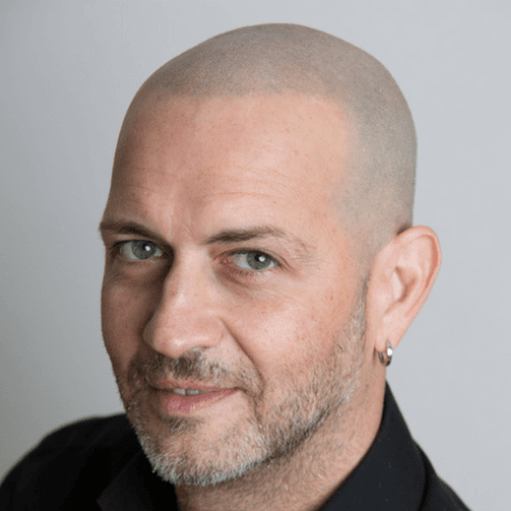 smp on grey hair
